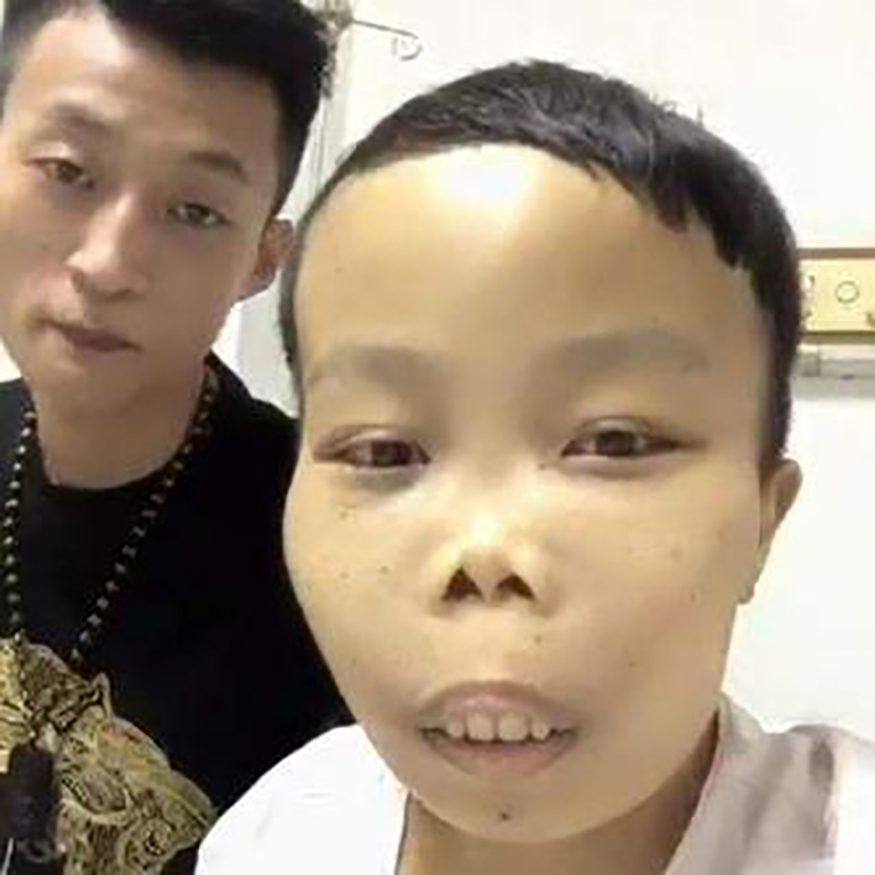 农村娃陈山,最丑网红陈山现状