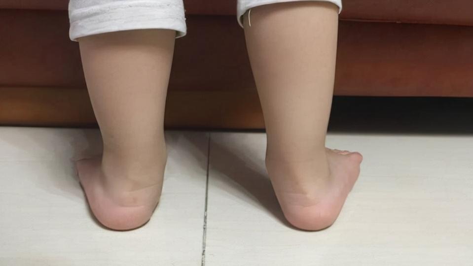 宝宝鞋跟外侧轻微磨损,鞋跟外侧磨损严重是足外翻