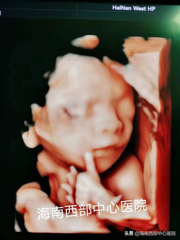 三维超声输卵管造影能当月怀孕么,输卵管超声造影怎么做视频全过程