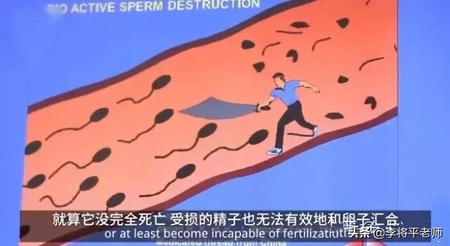 世界首例男性避孕针,印度发明男性避孕药