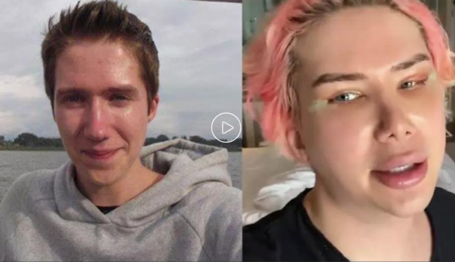 白人网红沉迷韩国流行文化，疯狂整容还做丁丁缩小术？