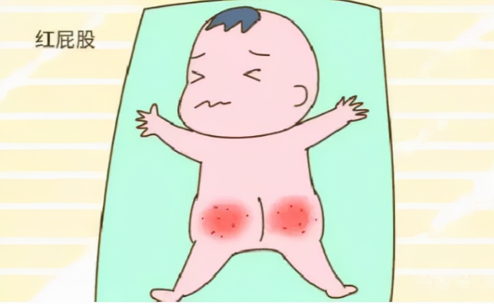 宝宝用的护臀膏有没有激素,宝宝平价好用护臀膏