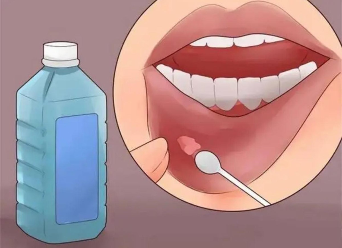 高血压患者服用维生素b2有帮助吗,维生素B2对高血压有帮助吗