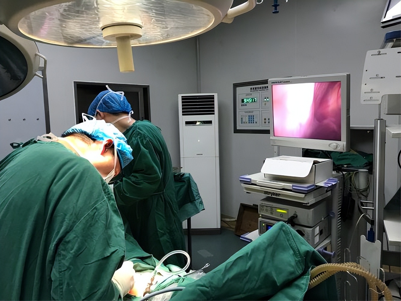 单孔腹腔镜的技术优势有哪些,有关妇科单孔腹腔镜手术的科普