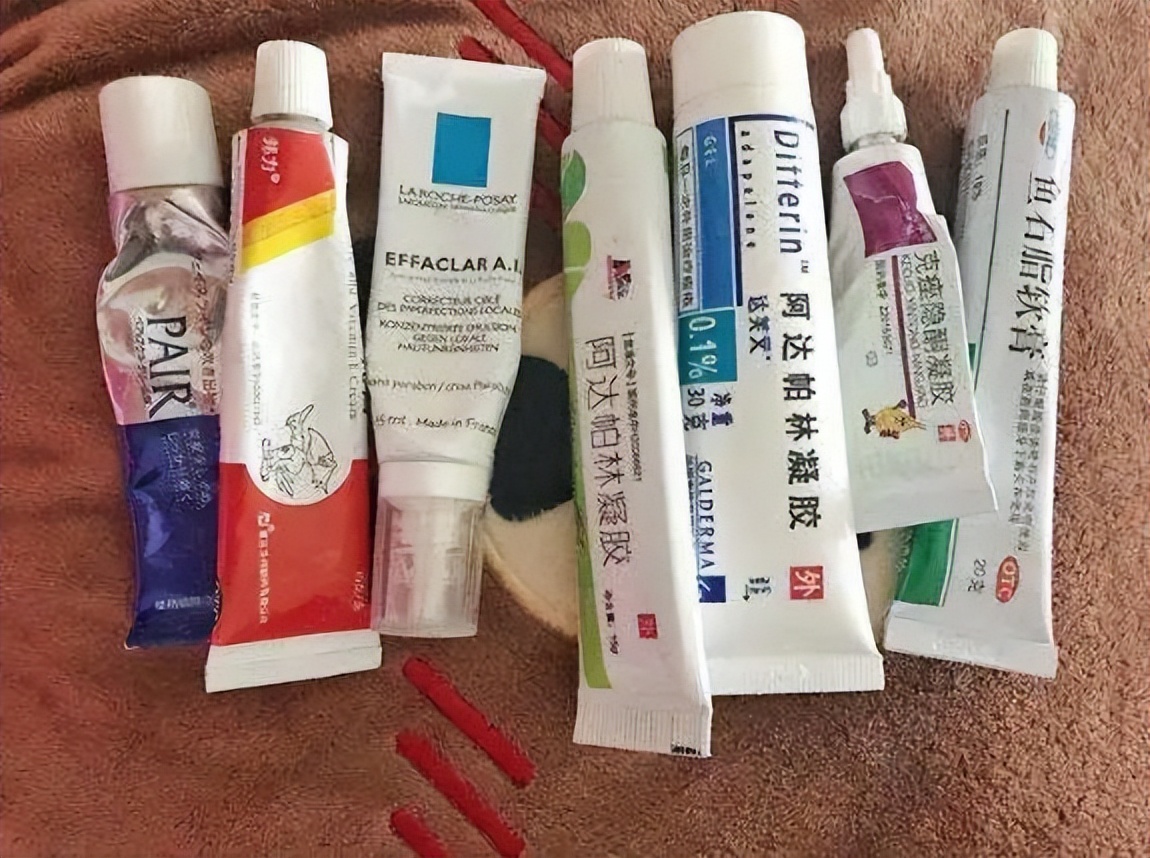 外用的激素类软膏都有哪些,激素类软膏外用有哪些