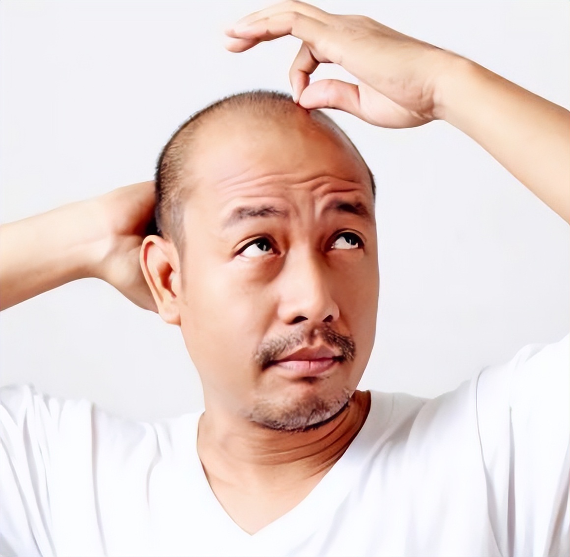 头皮痒抠出白泥是怎么回事,头皮抠出白泥头皮瘙痒如何治疗