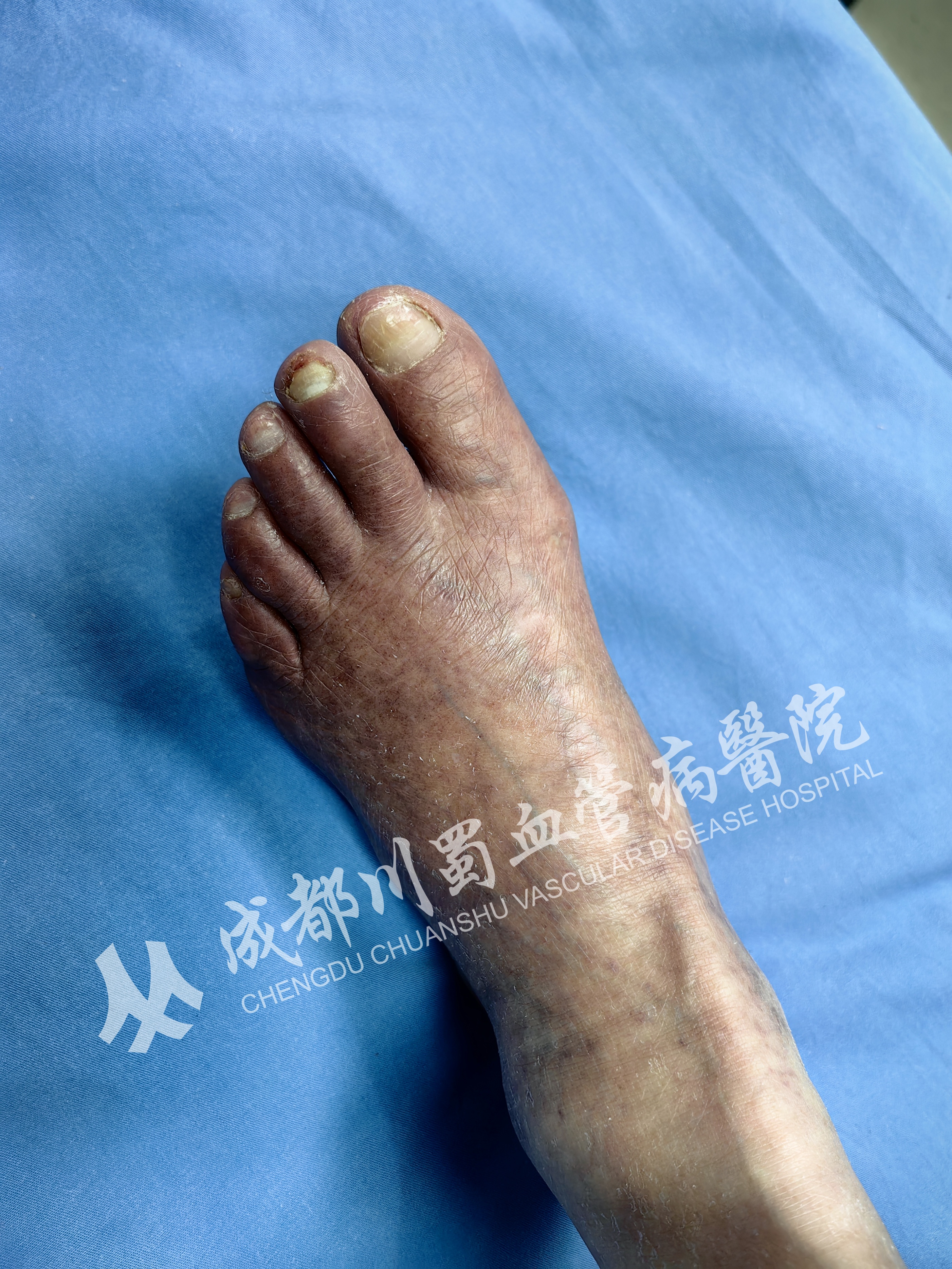 头晕记忆力衰退,头晕记忆力减退疲劳失眠