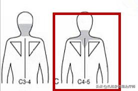 肩膀总是处于紧张状态怎么治疗,跑步肩膀僵硬怎么放松