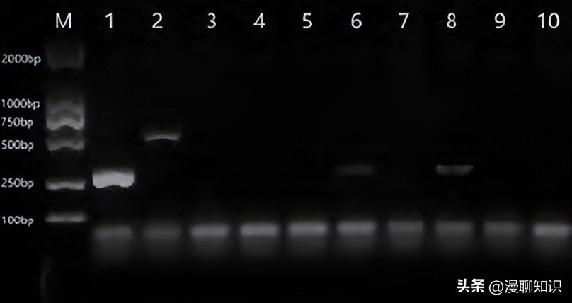 猫会感染人的疾病的图片,猫病毒检测cpr可以测出什么病毒