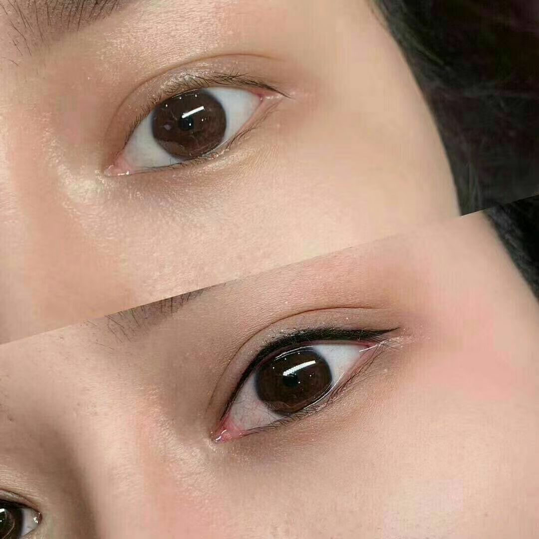 纹完美瞳线可以不用修复液吗,纹了美瞳线可以不抹修护液吗