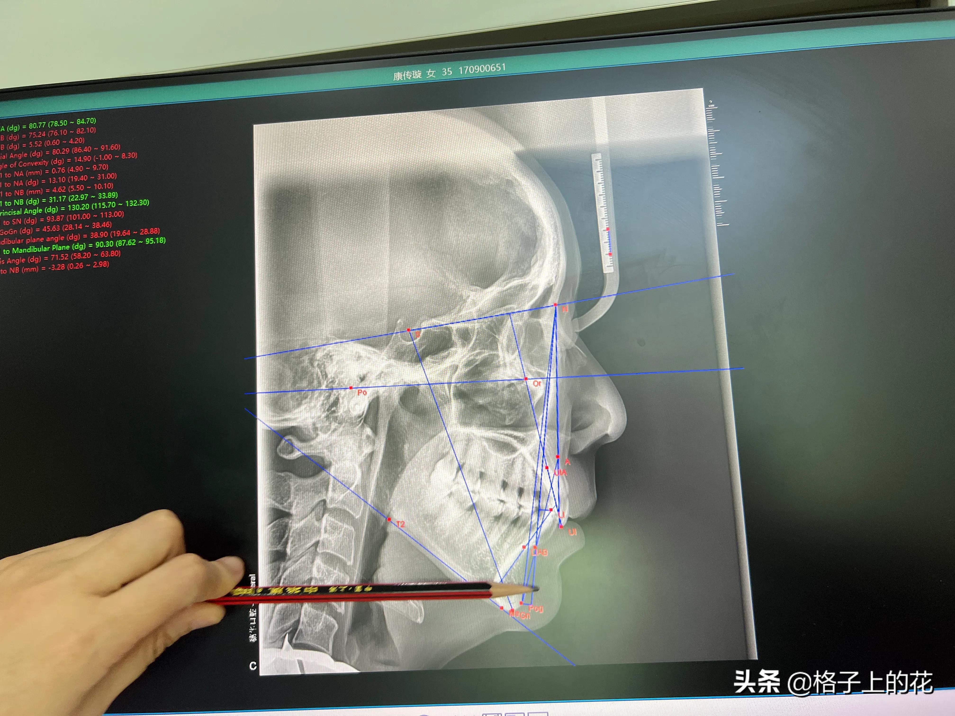 广州市正规的口腔医院,广州比较正规的口腔医院