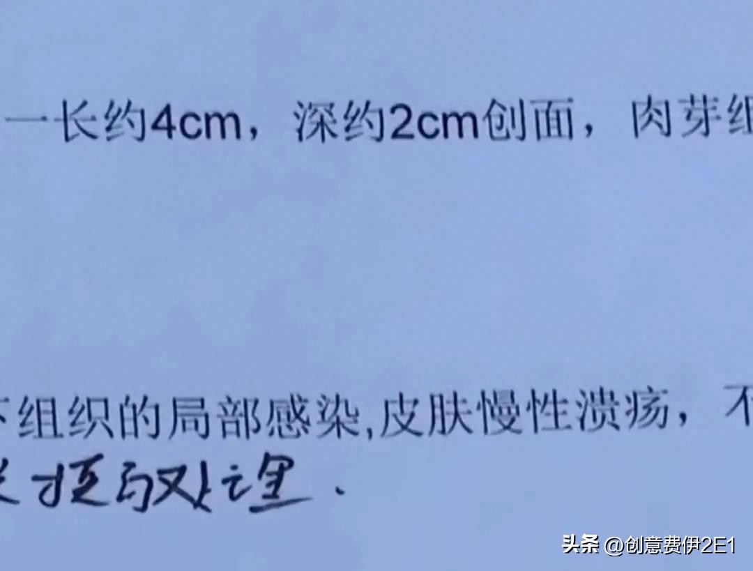 女生夜跑被恶犬咬伤后续,女子夜跑被恶犬咬伤在哪个部位