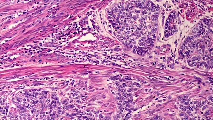 女性突然快绝经的10个征兆,女性突然绝经了是怎么回事