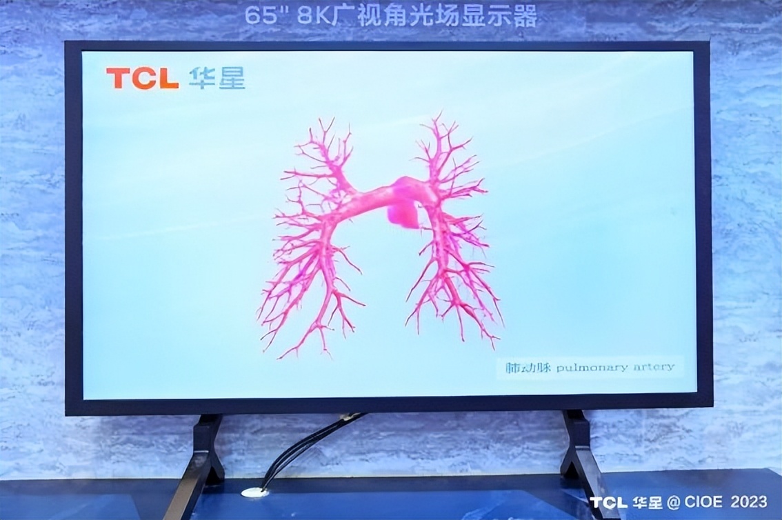 tcl华星简介视频,tcl华星未来发展