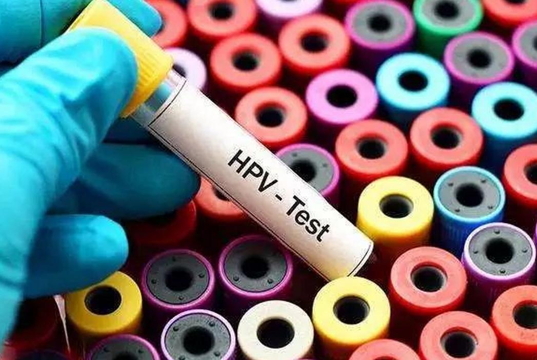 “裤子脱了腿张开”，医院里一个比一个尴尬的体检，你做过几个