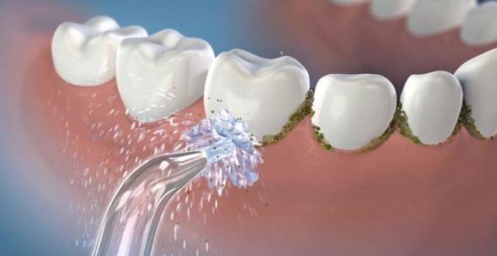 情人节送礼物佳选电动牙刷,平价水牙线冲牙器推荐