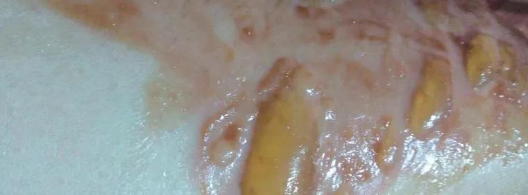 洗纹身真的不是一般人能承受的,洗纹身真的要下很大的决心