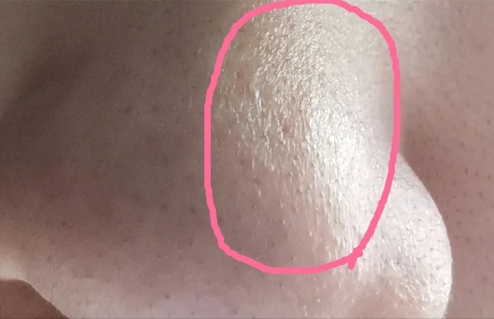 脸泛红是洗面奶的原因吗,为什么用完洗面奶脸会变白