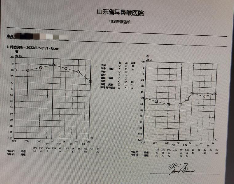 公交车司机耳聋怎么办,千里眼公交车司机突发疾病