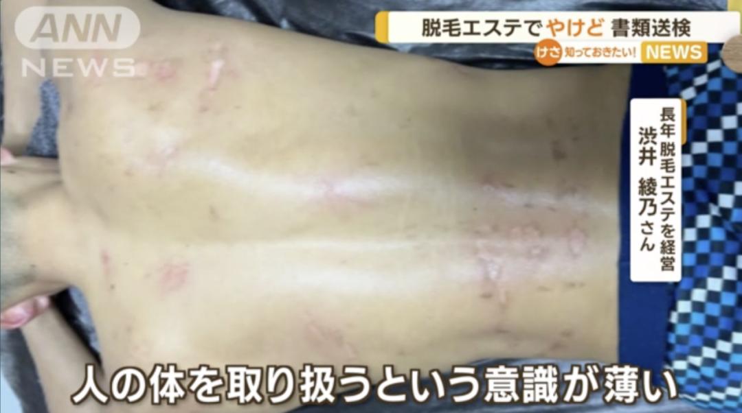 无良女医生非法做手术,女子被假医生做隆胸手术