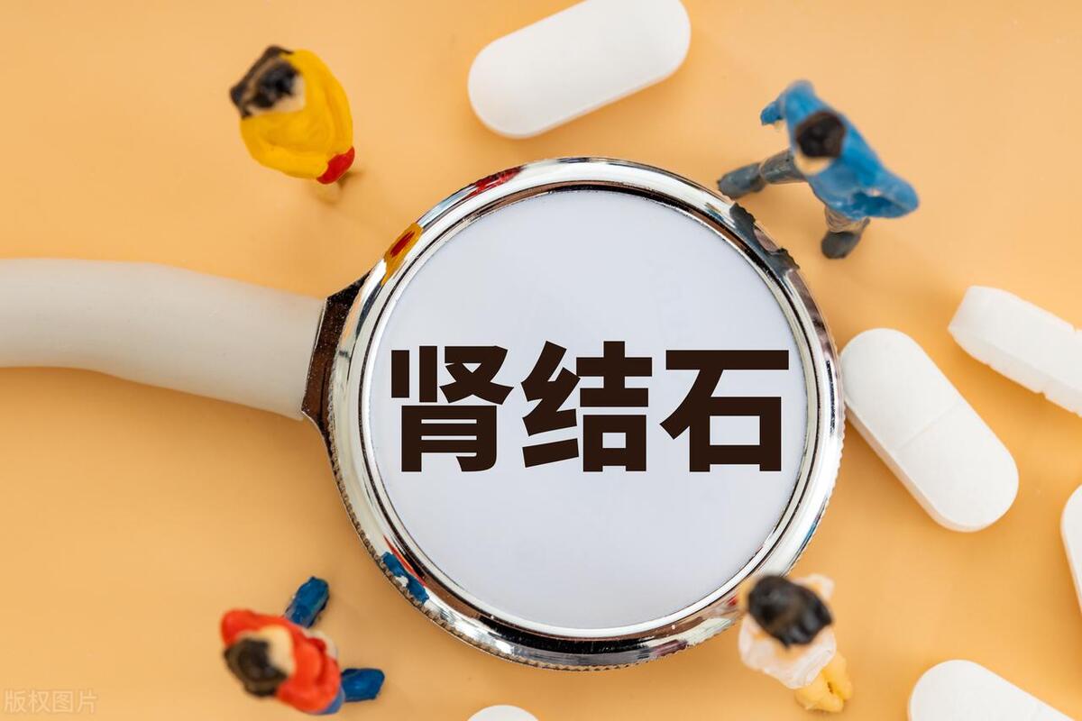 肾结石湿热,湿热有肾结石怎样治疗