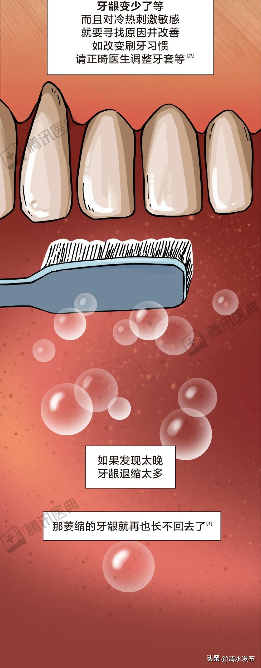 两边大牙一吃肉就塞牙如何修复,14岁学生吃肉老是塞牙需要矫正吗