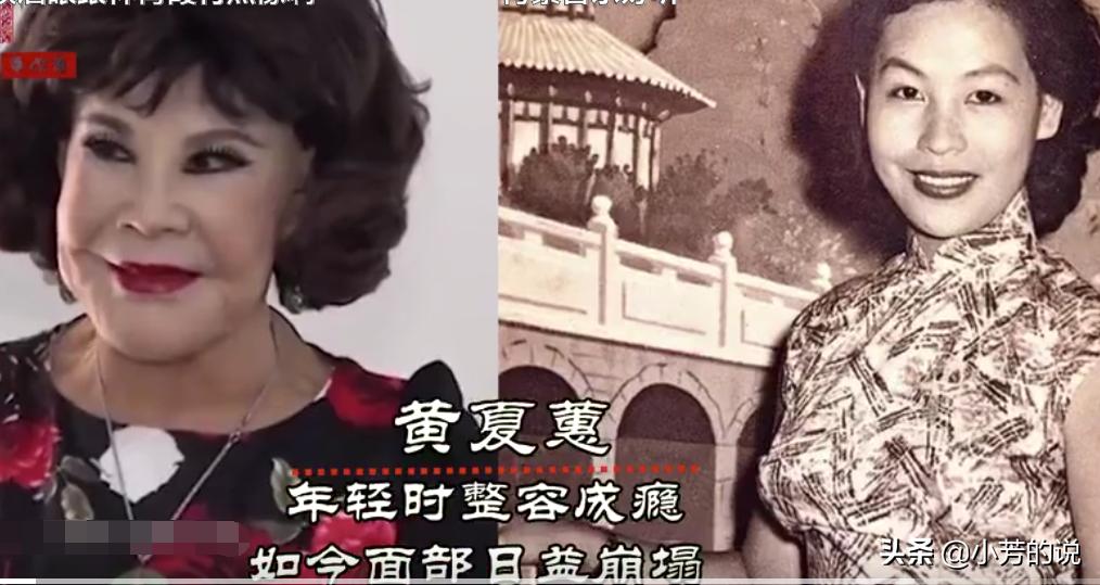 整容后出车祸假体外露,整容了被砸到脸会怎么样