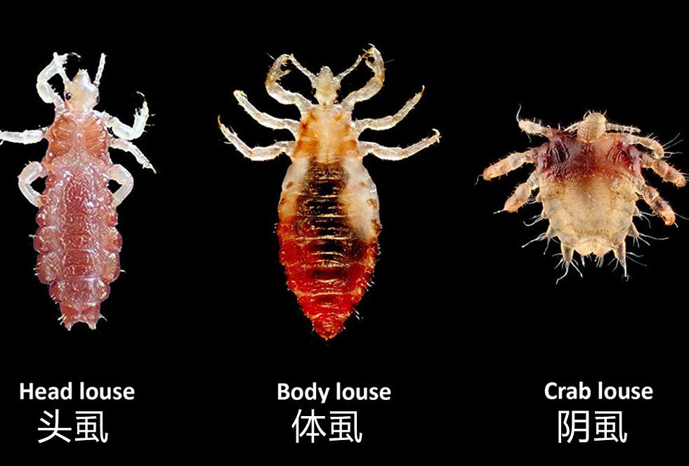 把阴虱用镊子找出来可以吗,阴虱是怎么通过性传播的