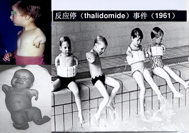 哮喘用沙丁胺醇还是氨茶碱,哮喘用沙丁还是甲茶碱类