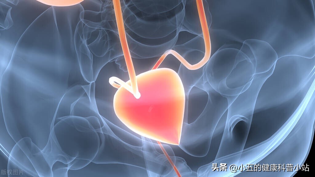 尿频尿急折磨人的膀胱过度活动症,尿频不是尿路感染是怎么回事