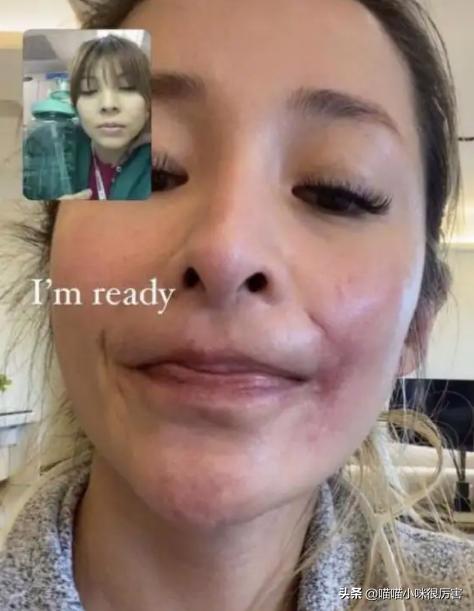 萧亚轩脸部变形,萧亚轩潇洒小姐mtv封神榜演唱会