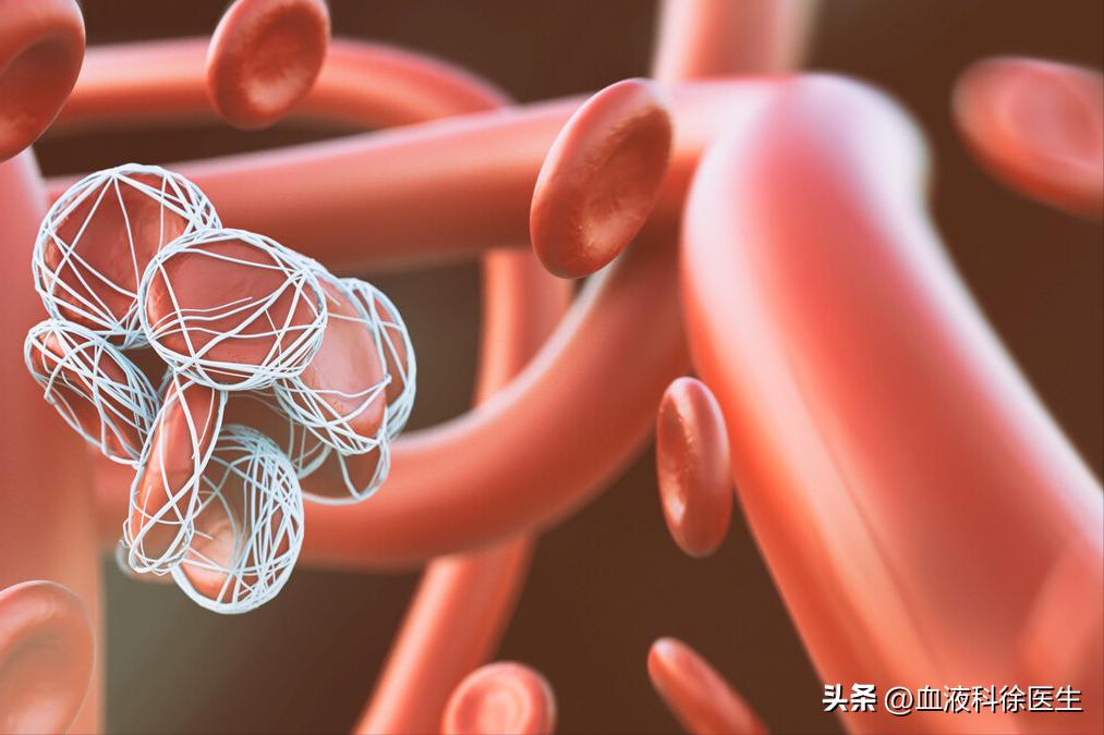 血栓手脚有什么症状和预兆,血栓来临手脚有啥感觉