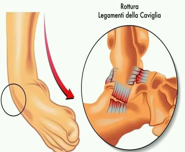 全国爱足日义诊宣传片,新时代文明实践爱心义诊