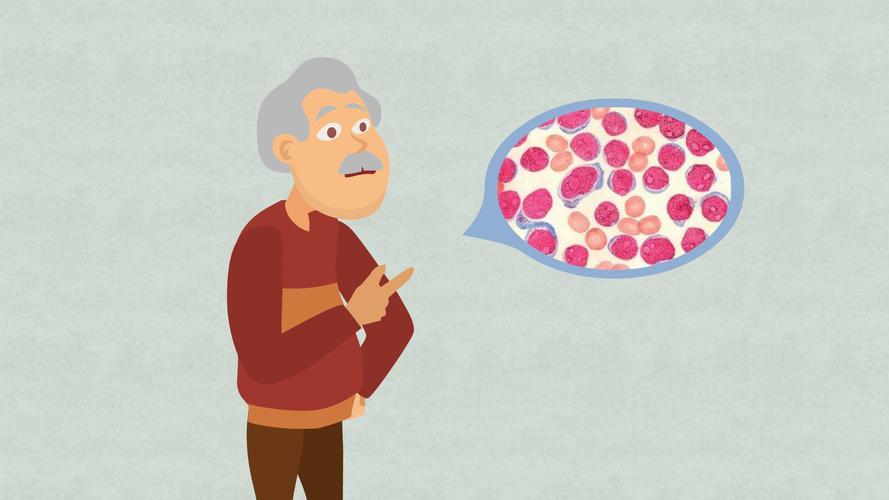 慢性白血病的征兆有哪些,慢性淋巴白血病之前会有什么征兆