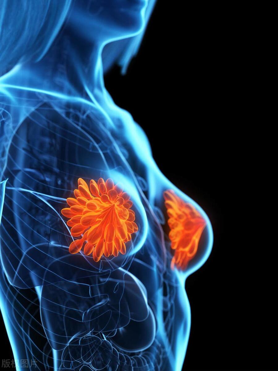 女性的胸，为啥不能乱揉？医生提醒：乱揉或与这4个危害有关。