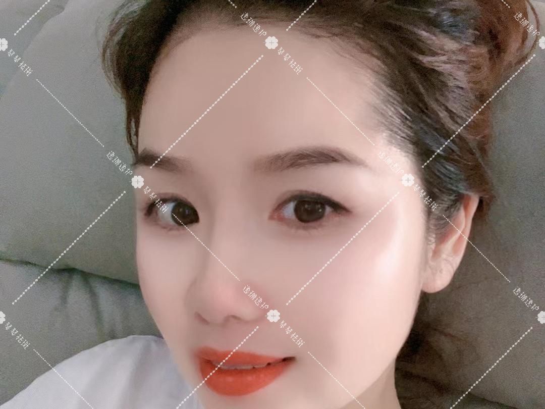 脸上长斑怎么快速消除最有效,脸上长斑怎样去除天然的祛斑方法