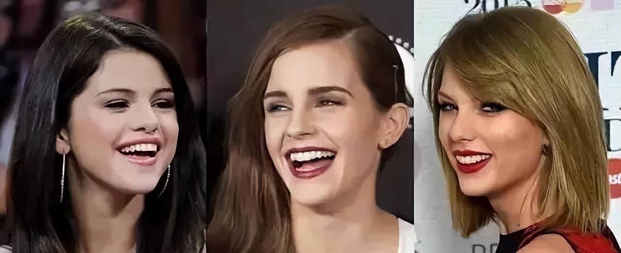 明星的牙都很齐吗,明星的牙齿都很好看