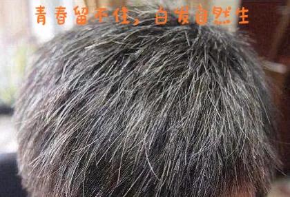 长白头发怎么办土方法,长白头发怎么办呀