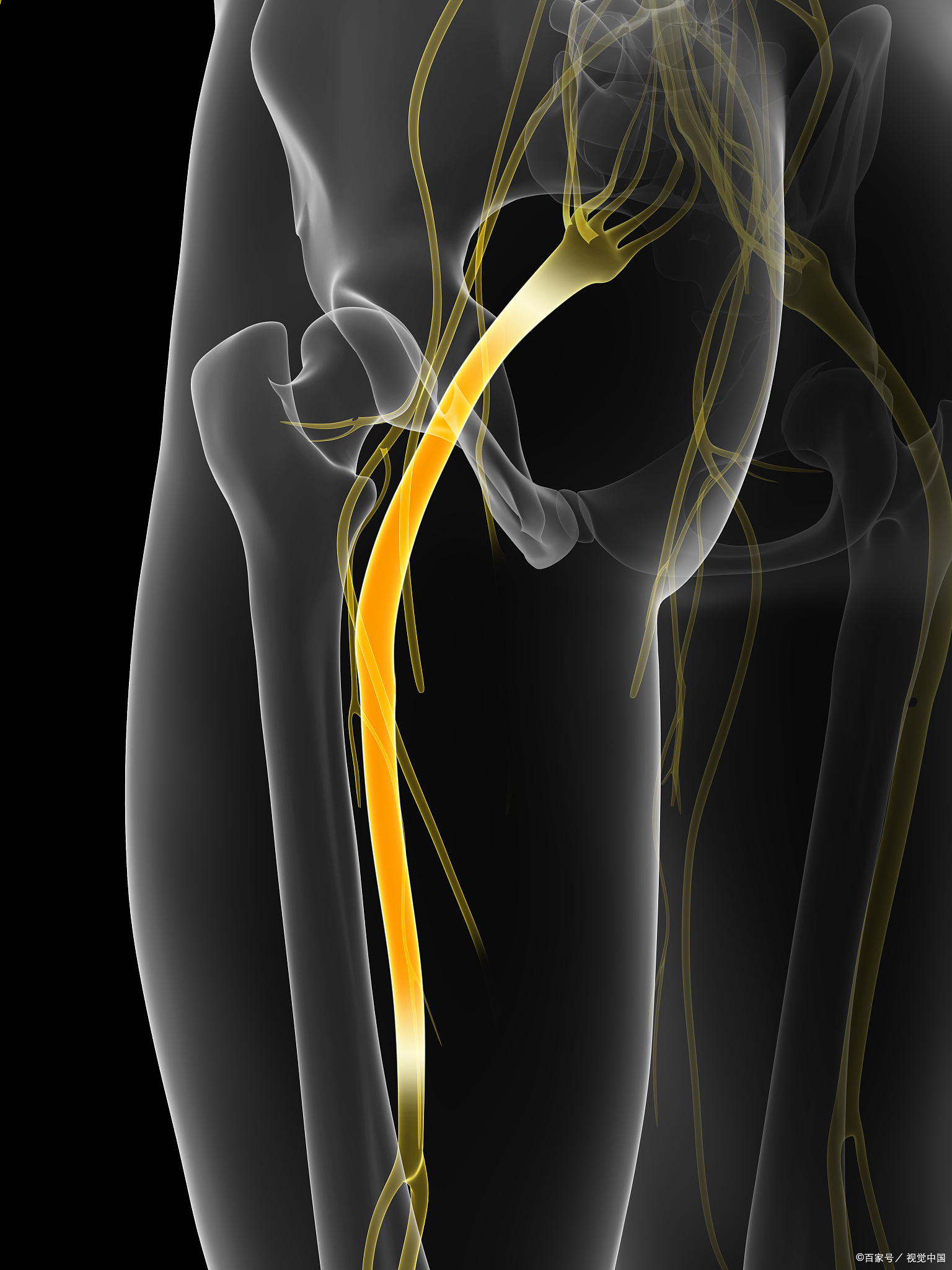 腰突压迫神经痊愈,腰突压迫坐骨神经吃什么中成药