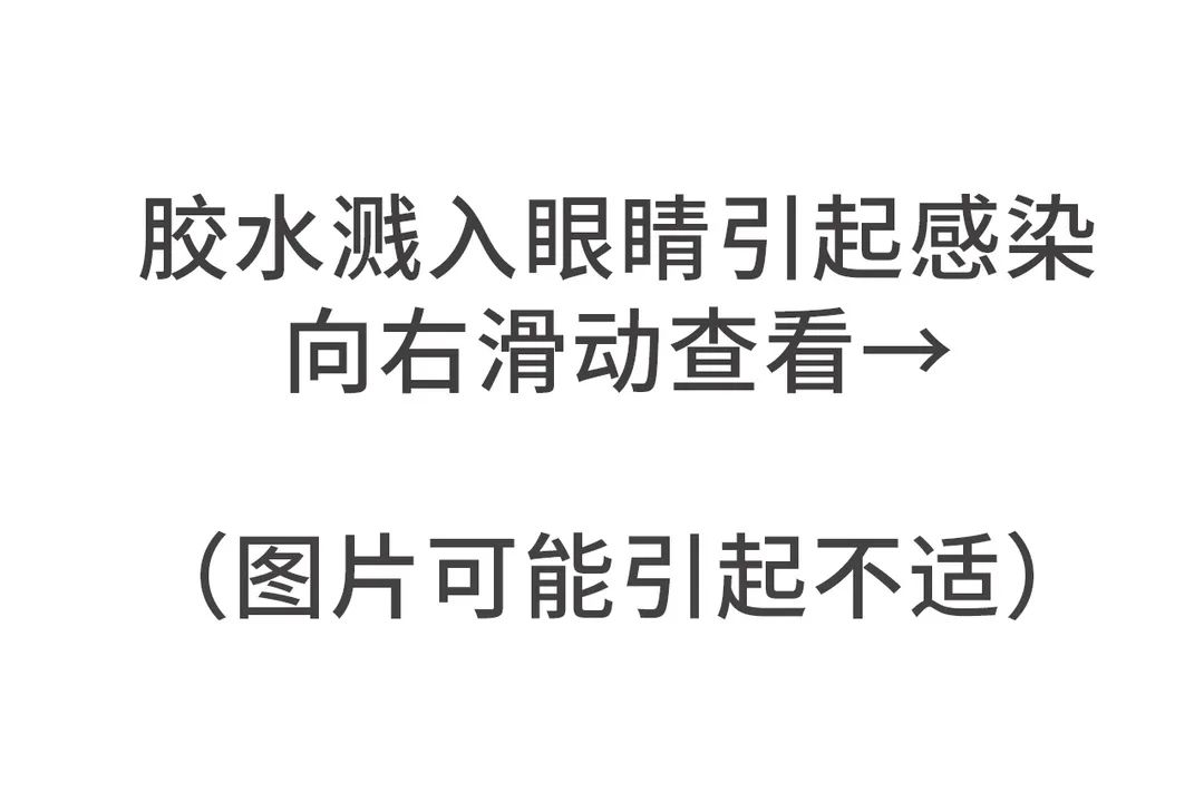 502不小心溅到眼睛里了怎么办,502溅了一点点进眼睛里了怎么办