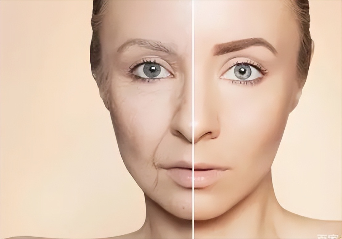 美容超声刀有危险吗,美容版超声刀的坏处