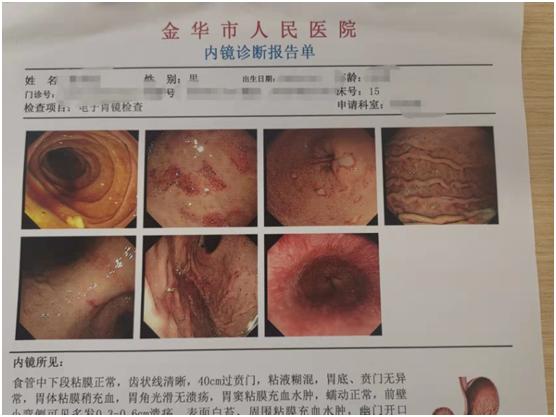 最简单的痛风，为什么却有许多痛风患者后果很严重？