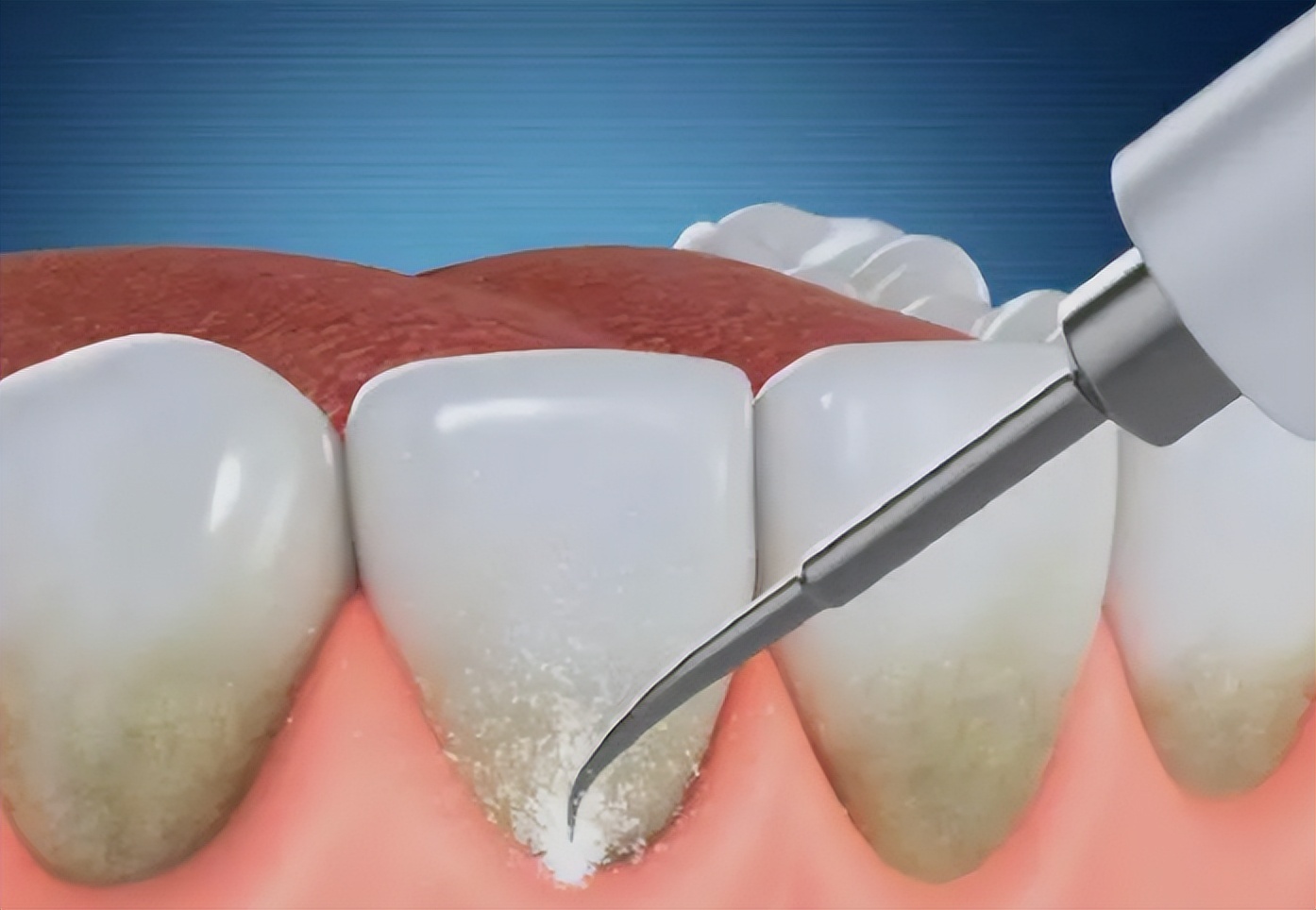 晚上睡觉嘴巴口干缺啥,晚上睡觉嘴巴总发干是真的缺水吗