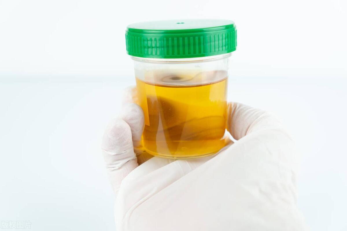 夜尿多有时会是尿频吗,夜尿多尿少是肾病吗