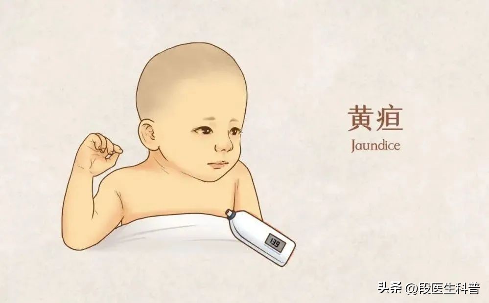 黄疸都有哪些明显症状,黄疸有哪些典型症状