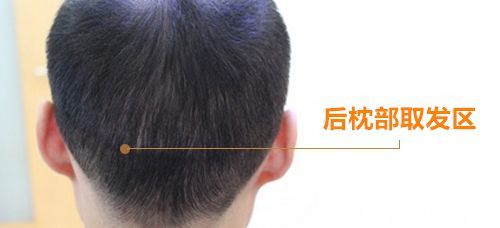 唇裂术后会不会留疤？家长的在意点尤其重要