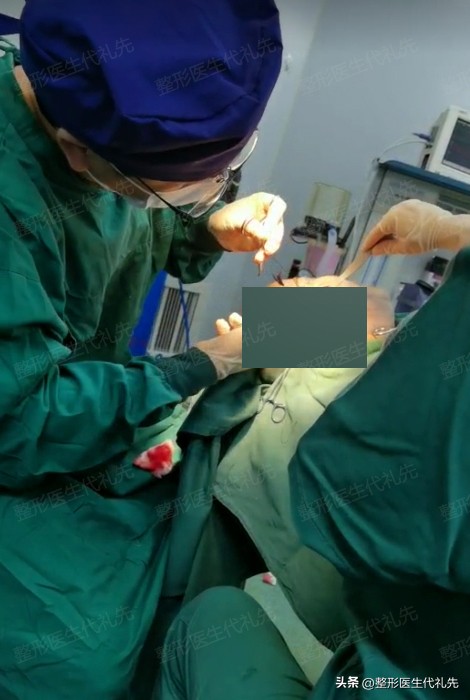 拉皮手术和面部提升术有什么区别,小拉皮和额头提升术的区别