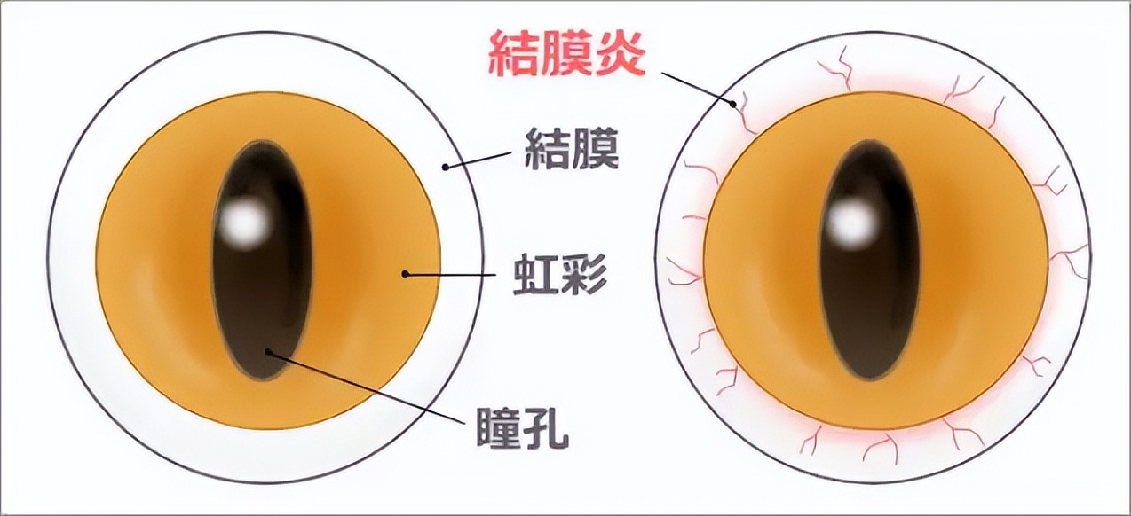 眼痒是什么病造成的,眼痒是什么病的前兆怎么治