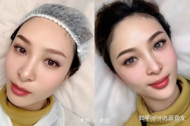 线条眉雾眉和丝雾眉的价格,眉毛厚适合雨雾眉和丝雾眉哪个好