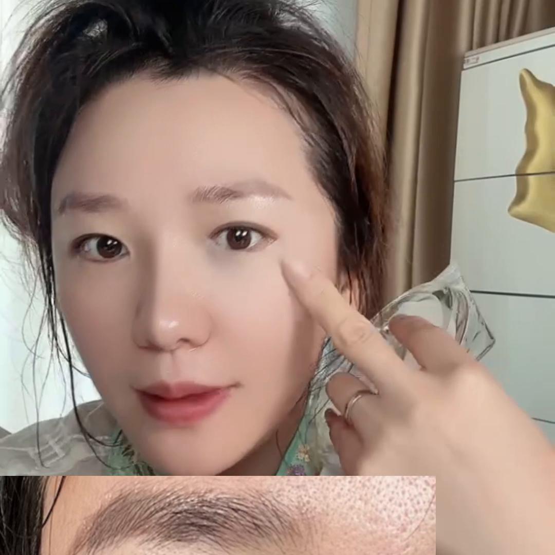 眼周细纹干纹泪沟如何解决,眼周细纹干纹多泪沟怎么办